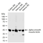 Alpha-Smooth Muscle Actin Antibody in Western Blot (WB)