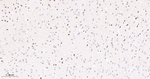 PARP1 (cleaved Asp214) Antibody in Immunohistochemistry (Paraffin) (IHC (P))