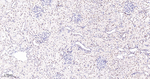 PARP1 (cleaved Asp214) Antibody in Immunohistochemistry (Paraffin) (IHC (P))