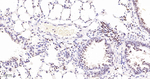 PARP1 (cleaved Asp214) Antibody in Immunohistochemistry (Paraffin) (IHC (P))