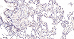 PARP1 (cleaved Asp214) Antibody in Immunohistochemistry (Paraffin) (IHC (P))