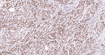 PARP1 (cleaved Asp214) Recombinant Rabbit Monoclonal Antibody (2A10)
