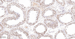 PARP1 (cleaved Asp214) Antibody in Immunohistochemistry (Paraffin) (IHC (P))