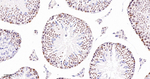 PARP1 (cleaved Asp214) Antibody in Immunohistochemistry (Paraffin) (IHC (P))