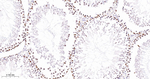 PARP1 (cleaved Asp214) Antibody in Immunohistochemistry (Paraffin) (IHC (P))