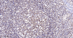 PARP1 (cleaved Asp214) Antibody in Immunohistochemistry (Paraffin) (IHC (P))