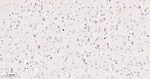 PARP1 (cleaved Asp214) Antibody in Immunohistochemistry (Paraffin) (IHC (P))