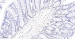 PARP1 (cleaved Asp214) Antibody in Immunohistochemistry (Paraffin) (IHC (P))