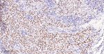 PARP1 (cleaved Asp214) Antibody in Immunohistochemistry (Paraffin) (IHC (P))