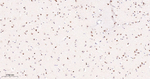 PARP1 (cleaved Asp214) Antibody in Immunohistochemistry (Paraffin) (IHC (P))