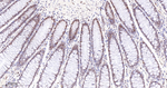 PARP1 (cleaved Asp214) Antibody in Immunohistochemistry (Paraffin) (IHC (P))