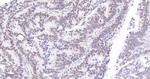 PARP1 (cleaved Asp214) Antibody in Immunohistochemistry (Paraffin) (IHC (P))