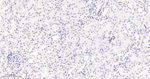 PARP1 (cleaved Asp214) Antibody in Immunohistochemistry (Paraffin) (IHC (P))