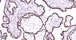 Cytokeratin 8 Antibody in Immunohistochemistry (Paraffin) (IHC (P))