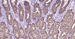Cytokeratin 8 Antibody in Immunohistochemistry (Paraffin) (IHC (P))
