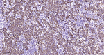 Cytokeratin 8 Antibody in Immunohistochemistry (Paraffin) (IHC (P))