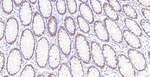 Cytokeratin 8 Antibody in Immunohistochemistry (Paraffin) (IHC (P))