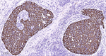 Cytokeratin 8 Antibody in Immunohistochemistry (Paraffin) (IHC (P))