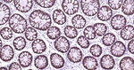 Cytokeratin 8 Antibody in Immunohistochemistry (Paraffin) (IHC (P))