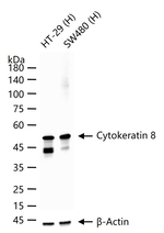 Cytokeratin 8 Antibody in Western Blot (WB)