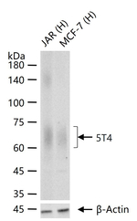 5T4 Antibody in Western Blot (WB)