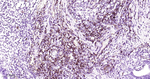 CD31 Antibody in Immunohistochemistry (Paraffin) (IHC (P))