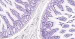 CD31 Antibody in Immunohistochemistry (Paraffin) (IHC (P))