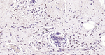 PARP1 Recombinant Rabbit Monoclonal Antibody (45G1)
