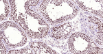 PARP1 Antibody in Immunohistochemistry (Paraffin) (IHC (P))