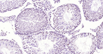 PARP1 Antibody in Immunohistochemistry (Paraffin) (IHC (P))