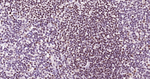 PARP1 Antibody in Immunohistochemistry (Paraffin) (IHC (P))