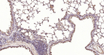 Calreticulin Antibody in Immunohistochemistry (Paraffin) (IHC (P))