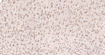 Calreticulin Antibody in Immunohistochemistry (Paraffin) (IHC (P))