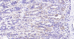 Calreticulin Antibody in Immunohistochemistry (Paraffin) (IHC (P))