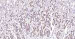 Calreticulin Antibody in Immunohistochemistry (Paraffin) (IHC (P))