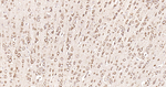 Calreticulin Antibody in Immunohistochemistry (Paraffin) (IHC (P))
