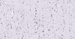 Calreticulin Antibody in Immunohistochemistry (Paraffin) (IHC (P))