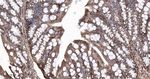 Calreticulin Antibody in Immunohistochemistry (Paraffin) (IHC (P))