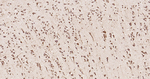 Calreticulin Antibody in Immunohistochemistry (Paraffin) (IHC (P))