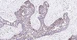 Calreticulin Antibody in Immunohistochemistry (Paraffin) (IHC (P))