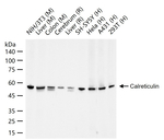 Calreticulin Antibody in Western Blot (WB)