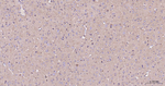RAB5 Antibody in Immunohistochemistry (Paraffin) (IHC (P))