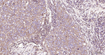 RAB5 Antibody in Immunohistochemistry (Paraffin) (IHC (P))