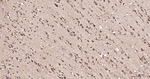 RAB5 Antibody in Immunohistochemistry (Paraffin) (IHC (P))
