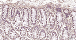 RAB5 Antibody in Immunohistochemistry (Paraffin) (IHC (P))