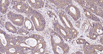 RAB5 Antibody in Immunohistochemistry (Paraffin) (IHC (P))