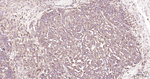 RAB5 Antibody in Immunohistochemistry (Paraffin) (IHC (P))
