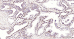 RAB5 Recombinant Rabbit Monoclonal Antibody (4A6)
