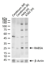 RAB5 Antibody in Western Blot (WB)