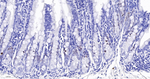 Ki-67 Antibody in Immunohistochemistry (Paraffin) (IHC (P))
